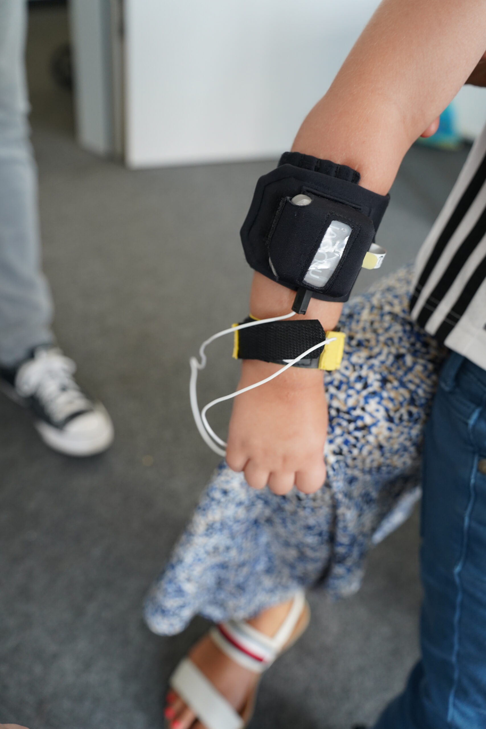 Image of an arm with a wristband for wearable electromyography measurement.